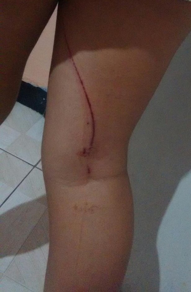 Estudante ficaram feridos ao fugirem dos assaltantes
