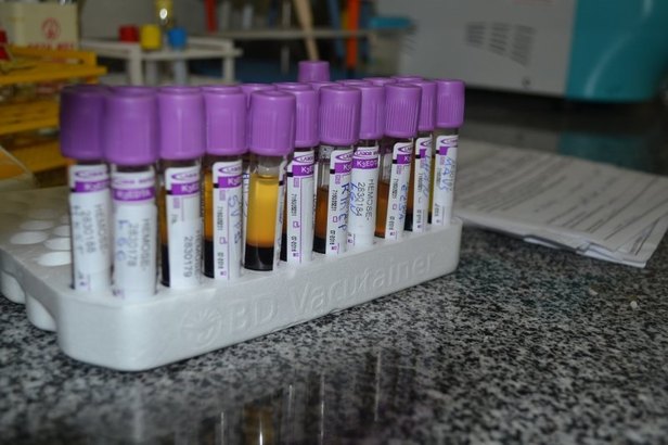 Foto: Ascom/SE