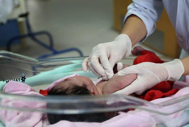 Foto: Ascom/SMS
